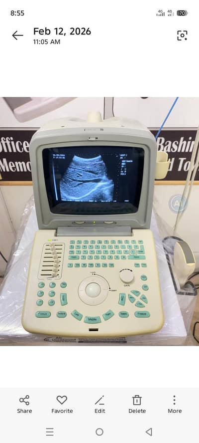 Ultrasound Machije