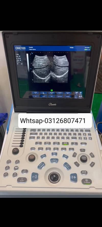 Ultrasound machine New/Used China/Japan Available-03126807471