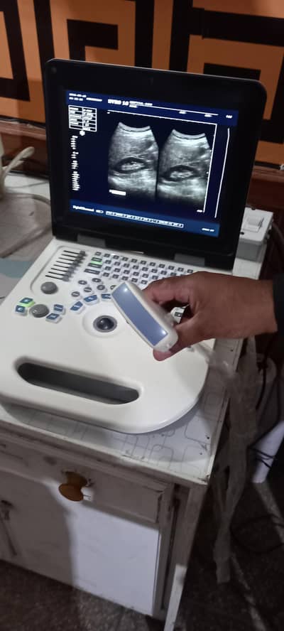 Ultrasound machine Like New condition Nyro-10 Sale-03126807471