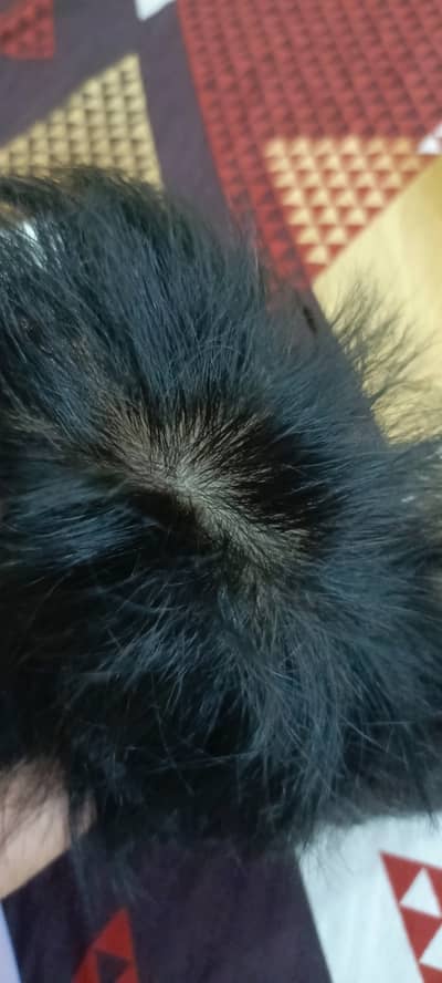 Hair patch