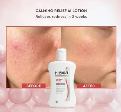 Physiogel AI Lotion | 125ml Left | Fixes Damaged Skin Barrier 