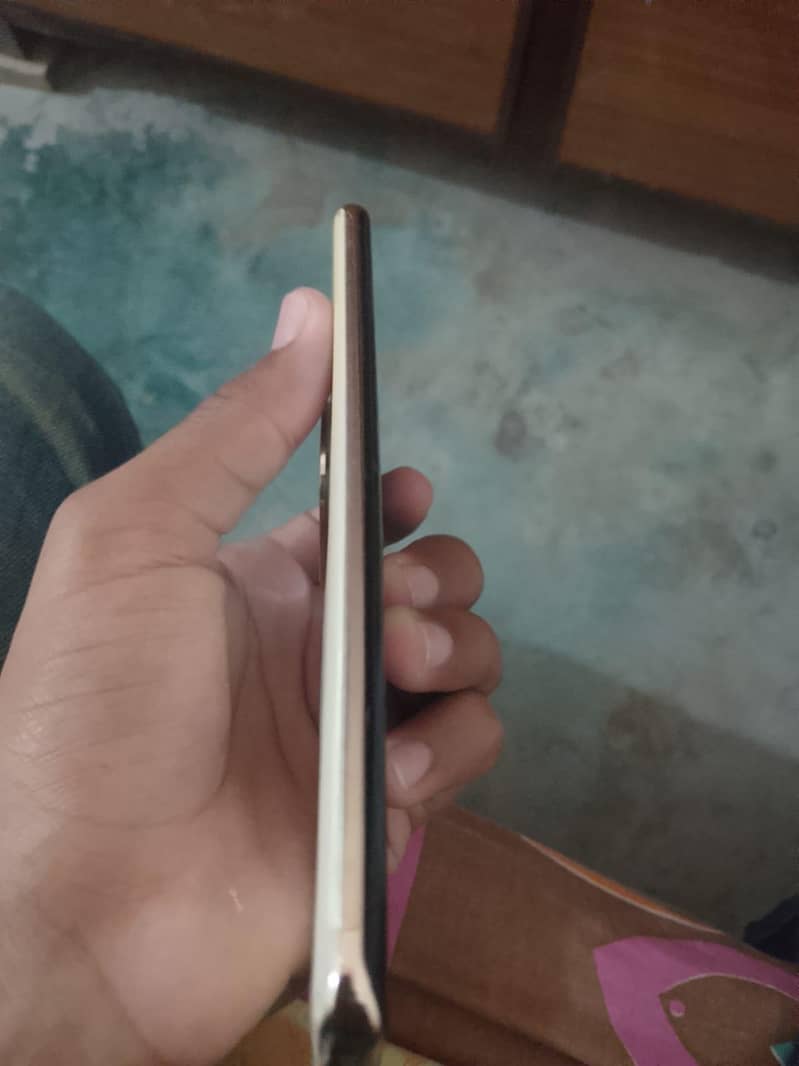 Infinix Zero 30 1