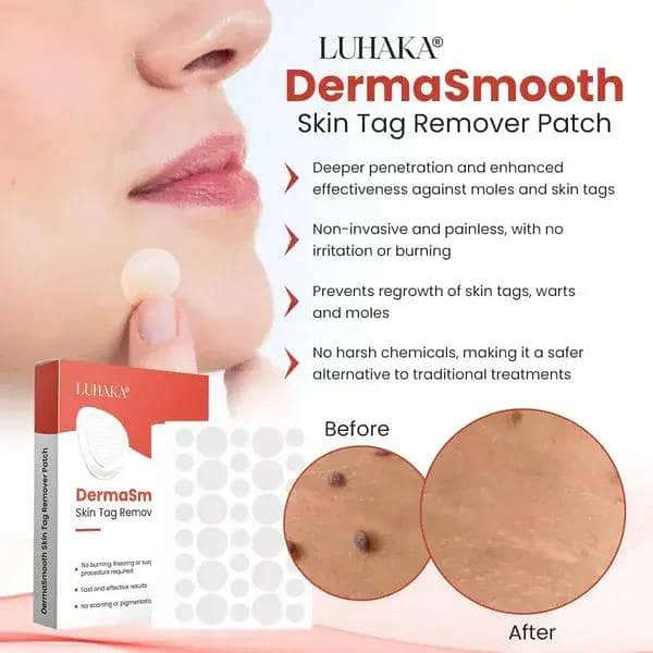 DermaSmooth Skin Tag Remover Patch 4