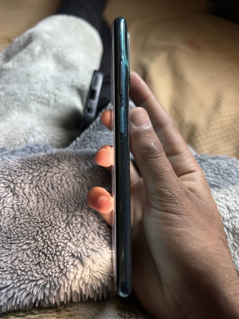 Redmi note 11 3