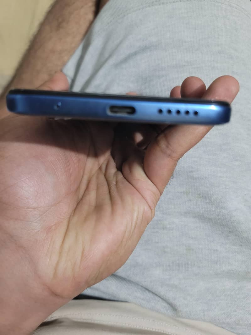 Redmi Note 11 3