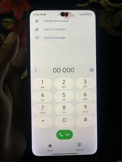 Redmi 10 all ok box nahi ha