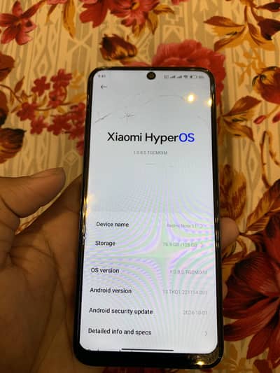 Redmi note 11