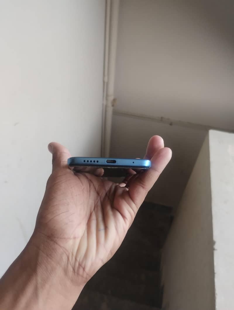 redmi note 11 3