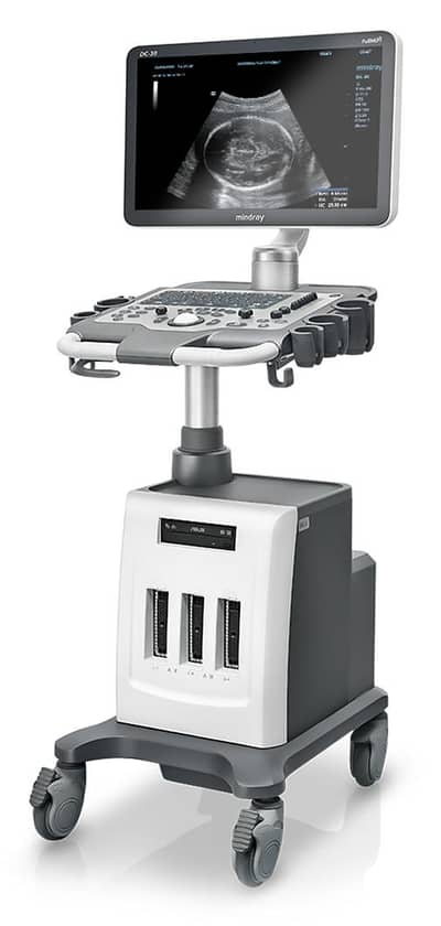 Mindray DC 30 Color Doppler