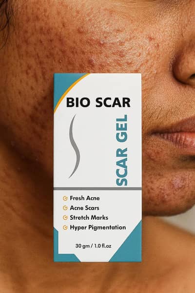 scar gel