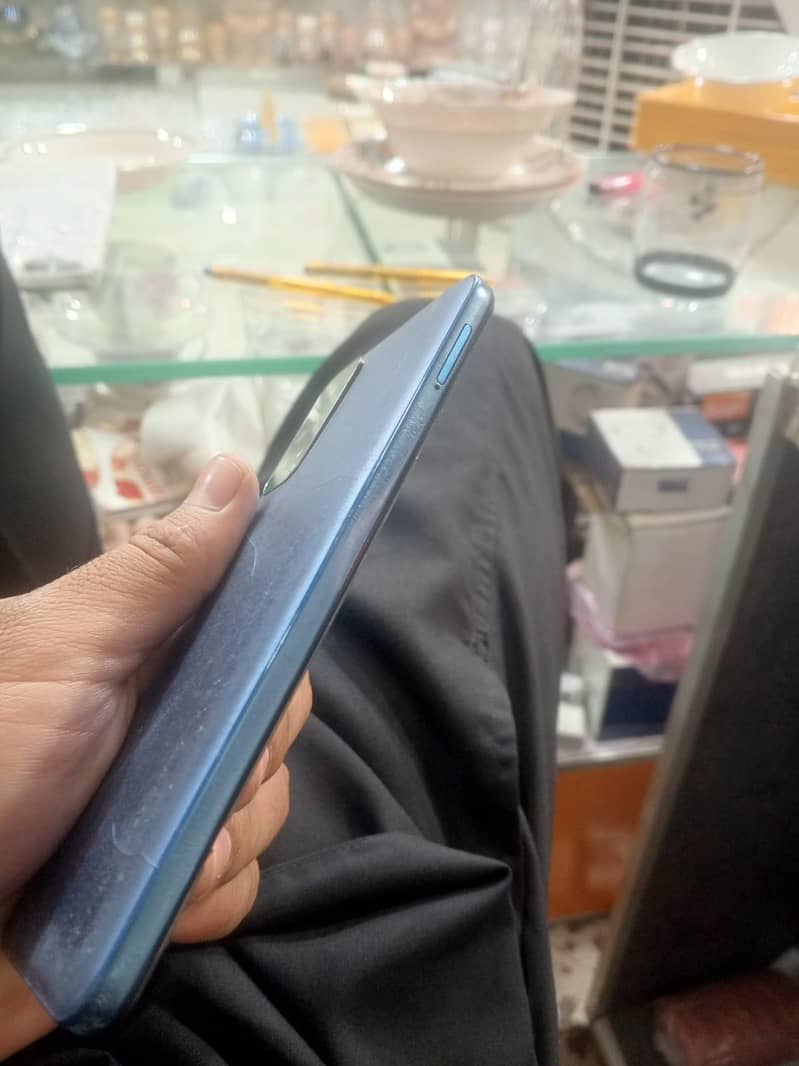 Xiaomi note 11 1