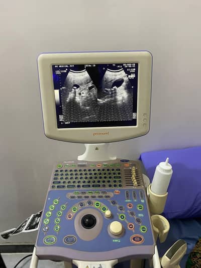 Hitachi Aloka Prosound 6 ultrasound machine
