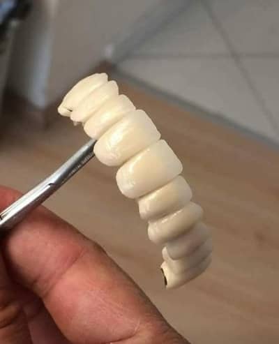 We Make High Quality Teeth At Our Lab