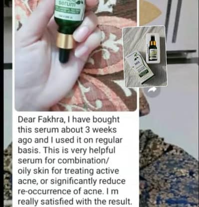 SCS acne kit - face wash , mask and serum | 100% original