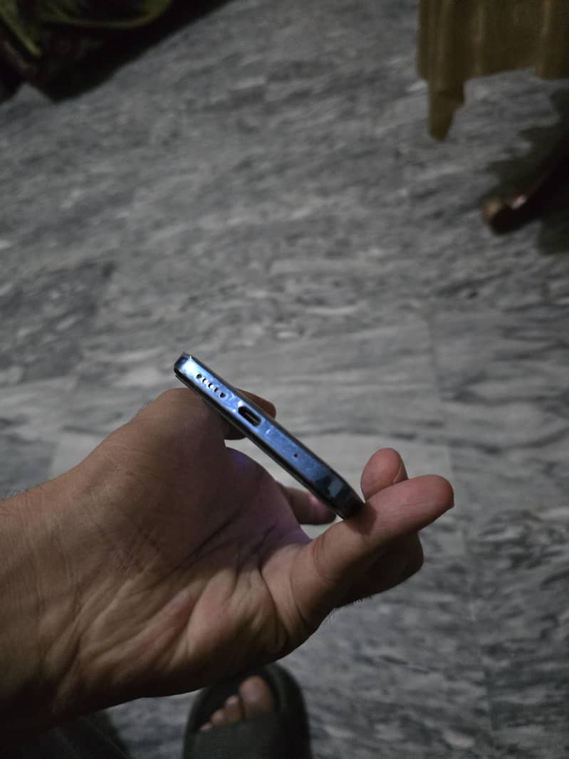 Xiaomi Redmi Note 11 3