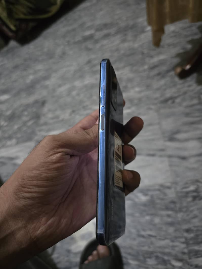 Xiaomi Redmi Note 11 4