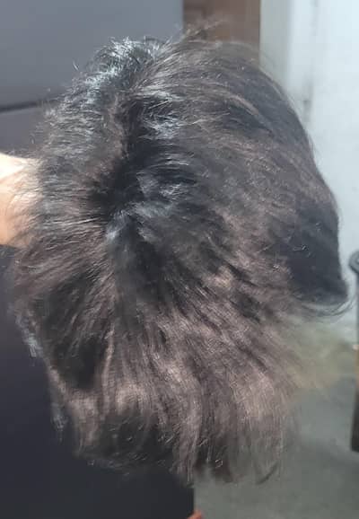 Hair Patch