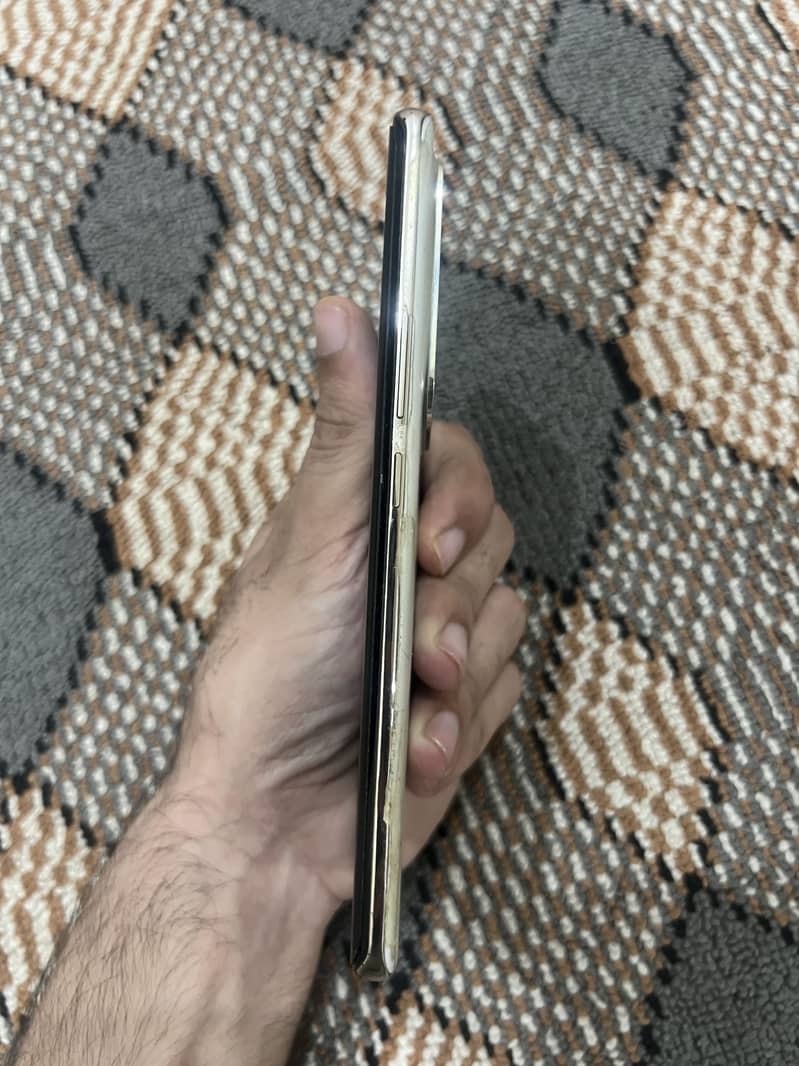 Infinix Zero 30 1