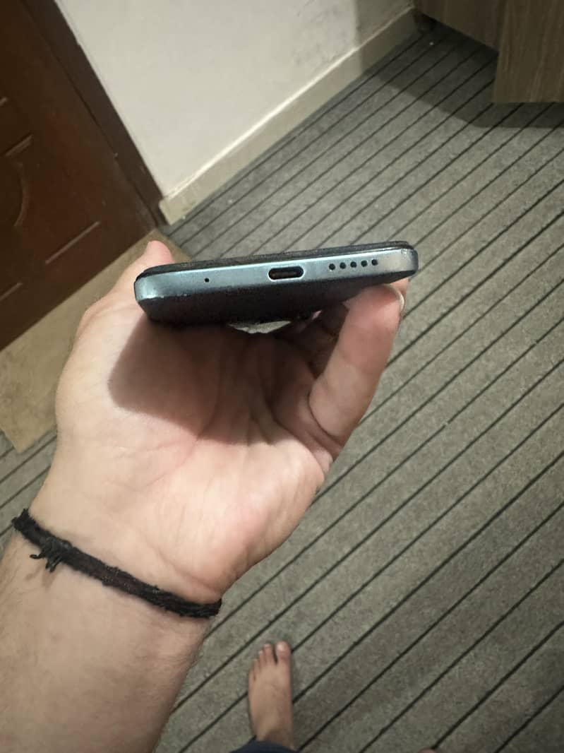 Redmi note 11 3