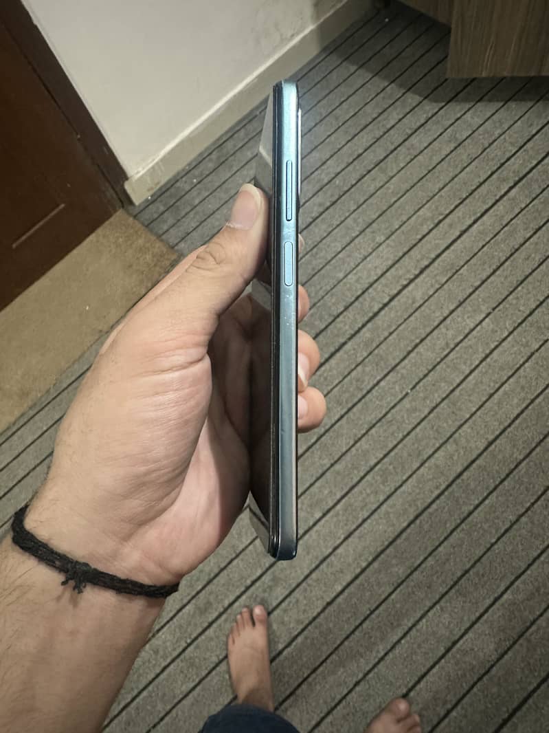 Redmi note 11 7