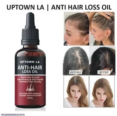 Anti-Hair Loss Oil 30ml for Hair Growth & Shine