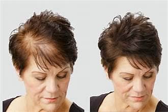 Toppik Hair Concealer Fibers – Quick Hair Density Solution