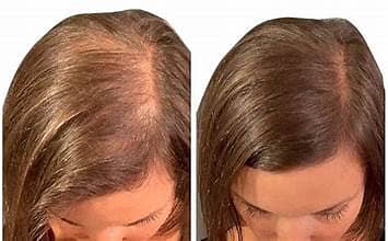 Toppik Hair Building Fibers – Instant Fuller & Thicker Looking Hair