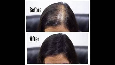 Genuine Toppik Hair Building Fiber | Natural Looking Results