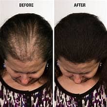 Original Caboki Hair Building Fibers – Instant Fuller & Thicker Looki