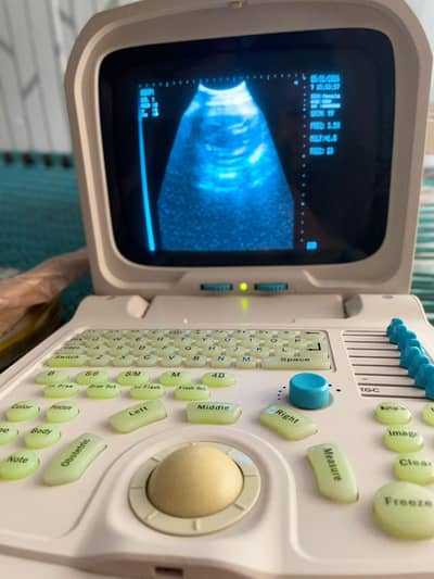 USG Ultrasound Machine for Sale – Excellent Condition