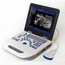 ultrasound machine Nyro 10