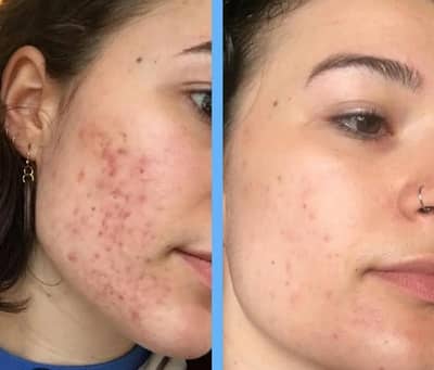 C Glow Vitamin C Serum