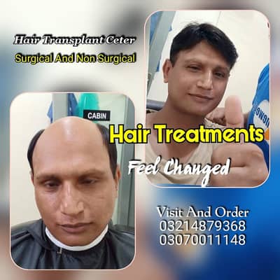 wig, hair wig, hair cap, hair topi, hair extensions