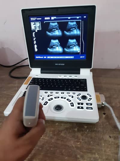 Notebook Ultrasound