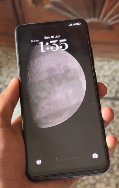 Xiaomi Redmi Note 11