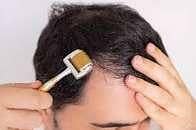 derma roller 1