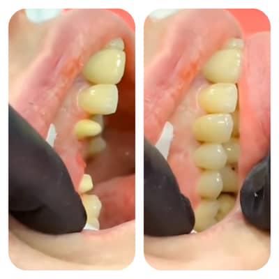 Female dental assistant required for dental clinic. fresh  ho jay eit'