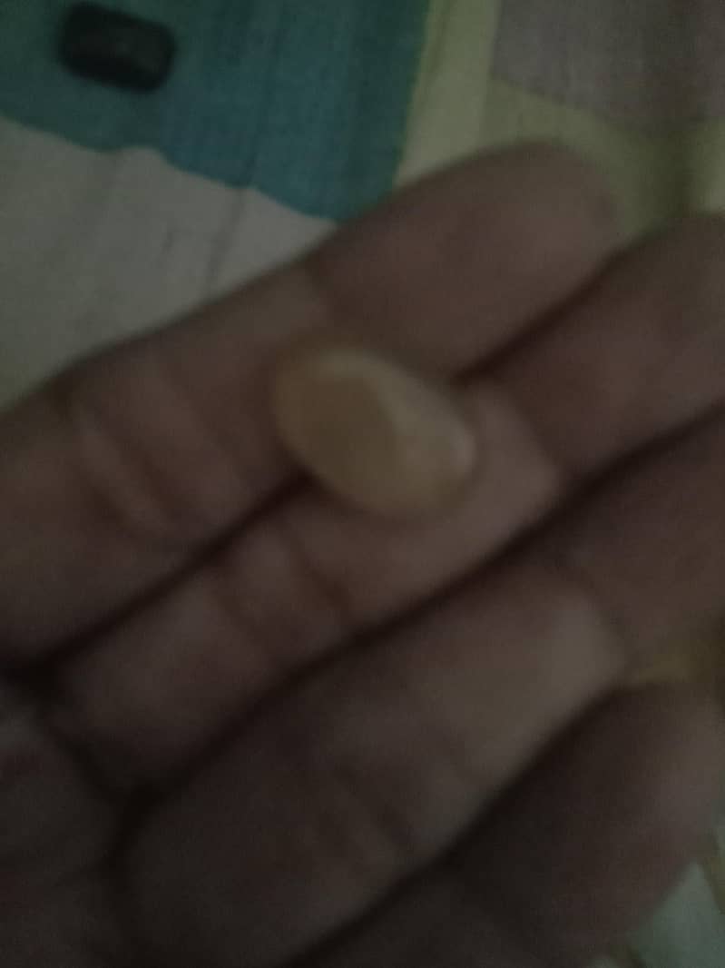 stone 1