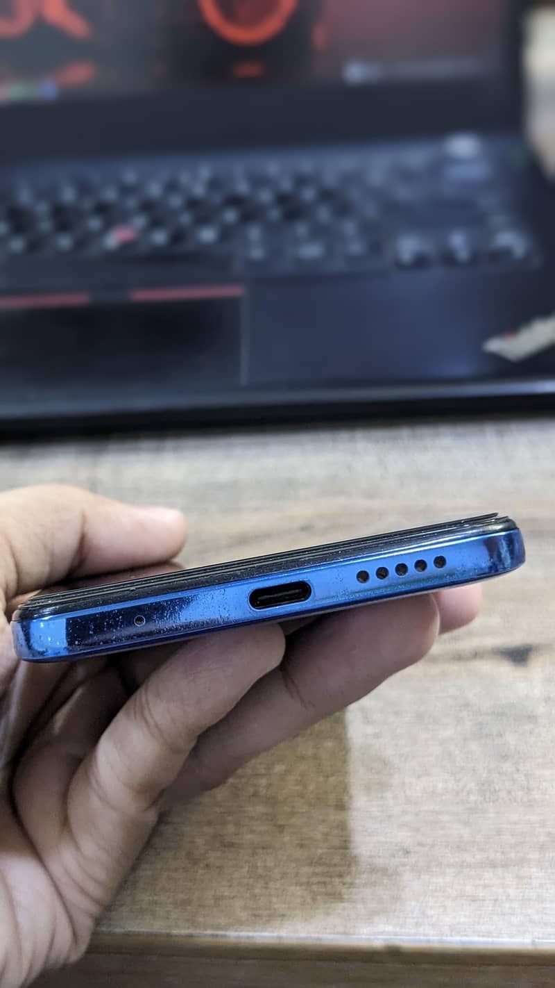 Redmi Note 11 3