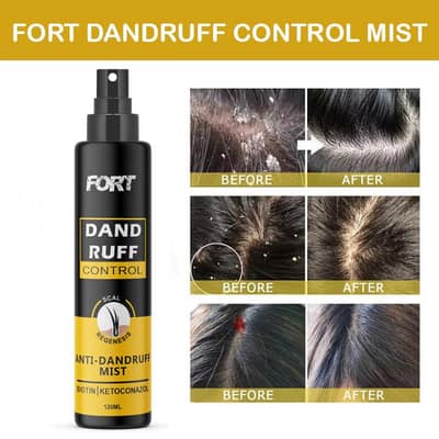 fort anti dandruff spray