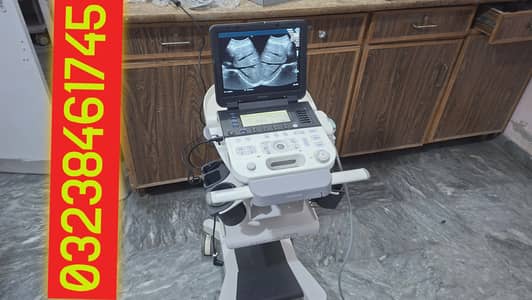 Fuji Fazon CB portable japanese colour Doppler ultrasound machine