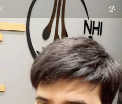 High Quality hair patch.