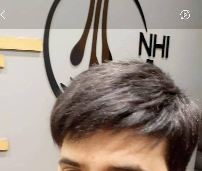 High Quality hair patch. 0