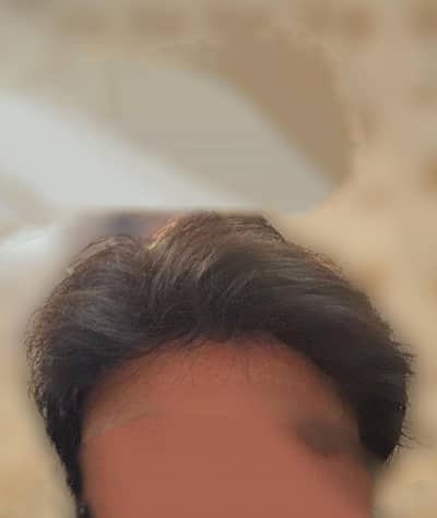 hair patch