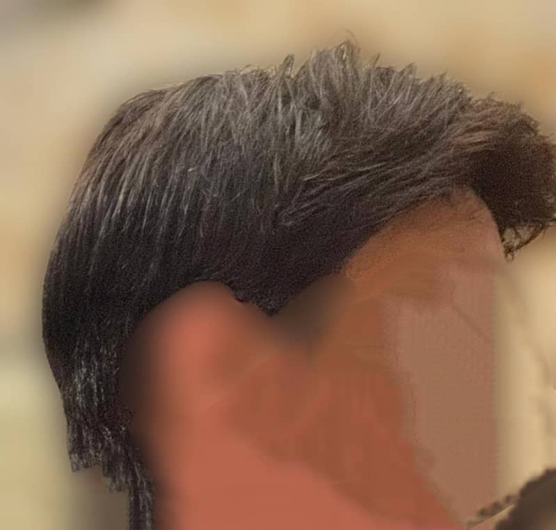 hair patch 2