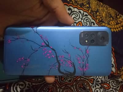 Xiaomi Redmi Note 11