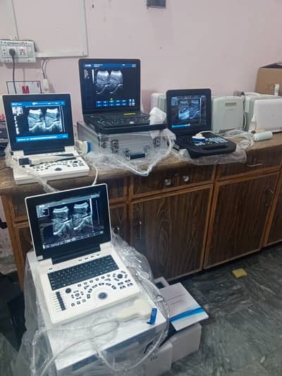 New & used Chinese ultrasound machine (with or without battery backup