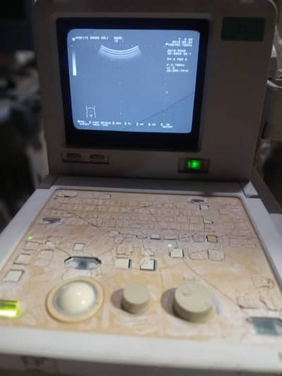 ultrasound