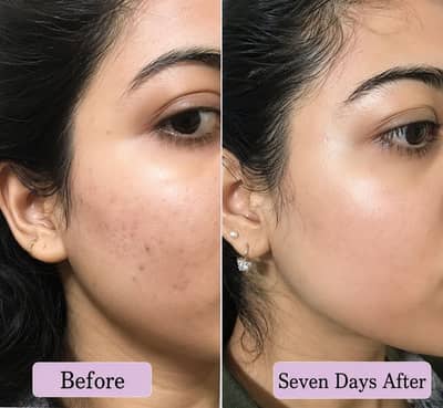 Advance whitening night cream