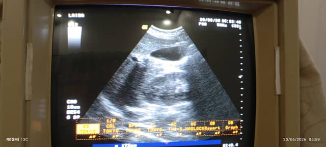 GE logic 400 ultrasound machine